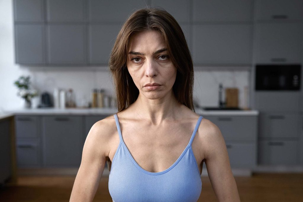 Жена с Оземпик лице, която е отслабнала нездравословно и прекалено бързо